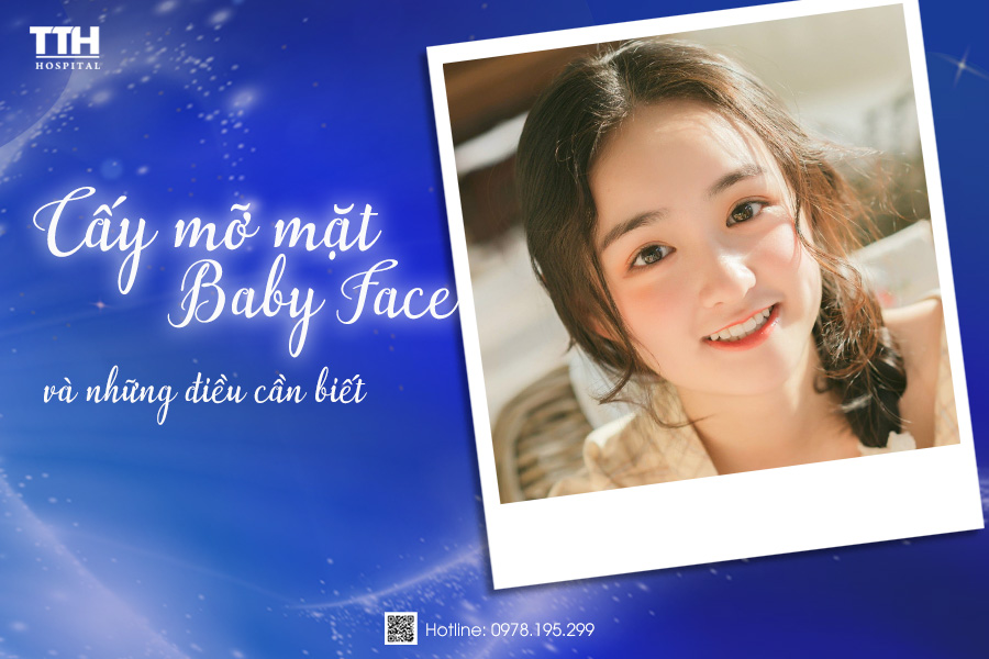 Cấy mỡ mặt Baby Face tại Nghệ An và những điều cần biết